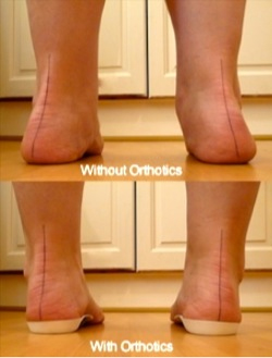 orthotics